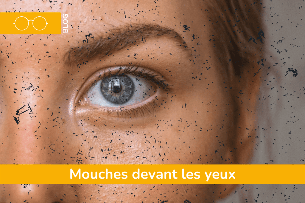 Les mouches devant les yeux BLOG, Parc Laser Vision Loire — free download