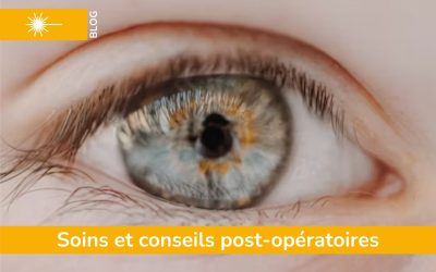 Comment bien prendre soin de ses yeux après une chirurgie laser à Saint-Étienne ?