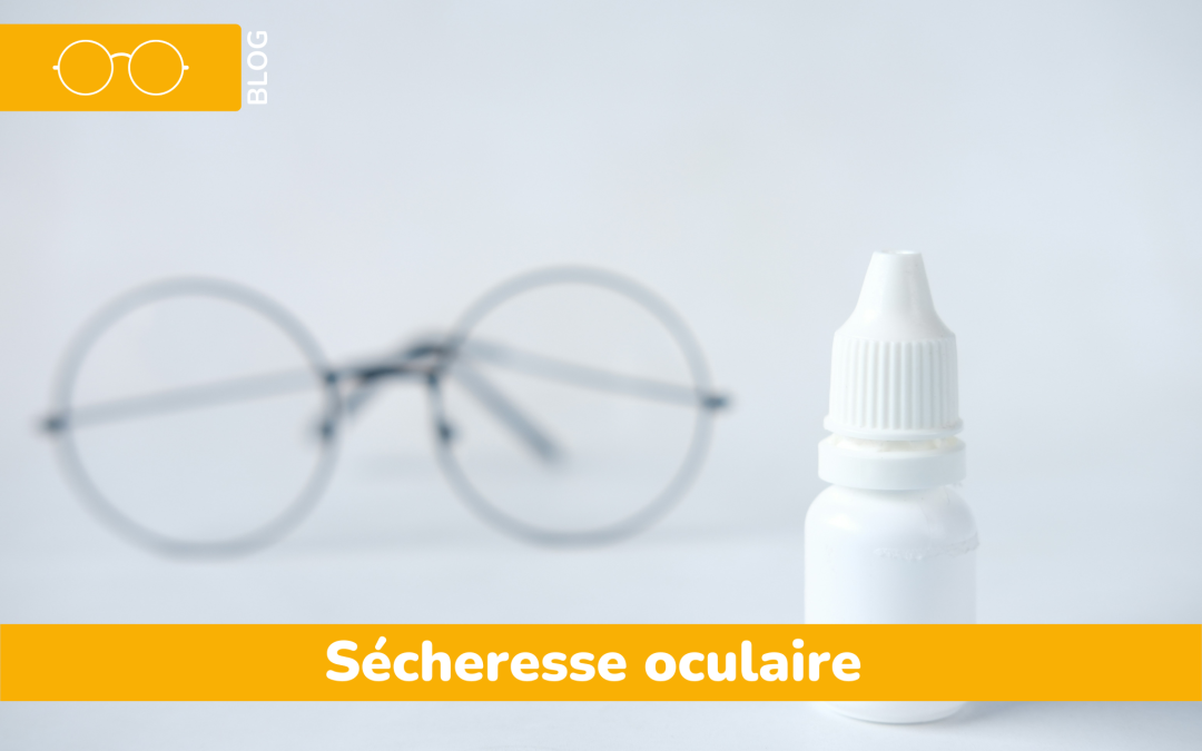 Syndrome de l’œil sec : symptômes, causes et solutions pour soulager les yeux irrités